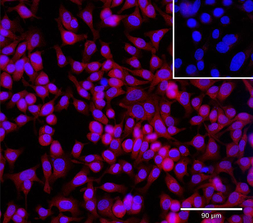 Ankyron CHST9_HUMAN Clone CV40765