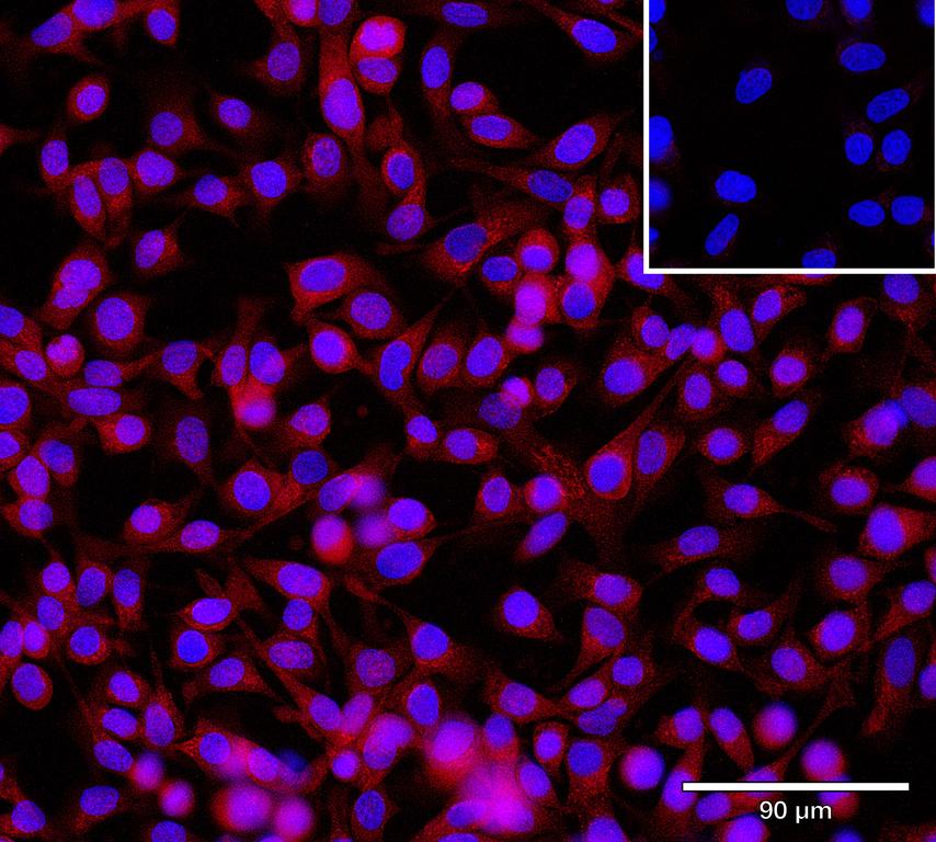 Ankyron CIB2_HUMAN Clone CV40394