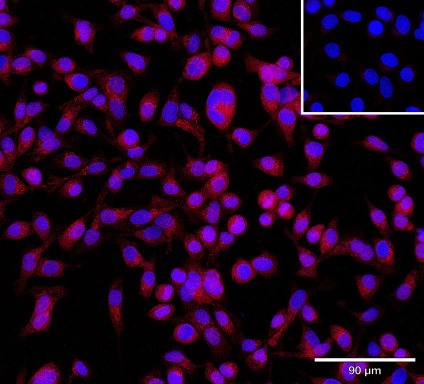 Ankyron CIB2_HUMAN Clone CV40396