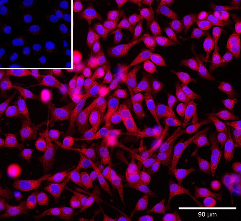 Ankyron CIB2_HUMAN Clone CV40404
