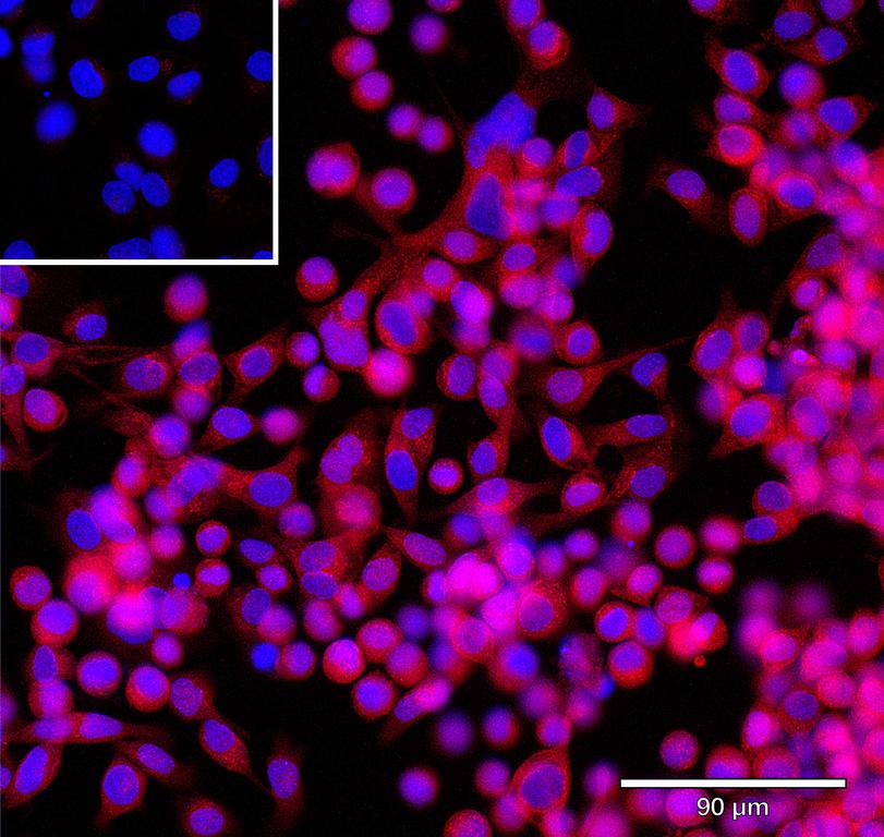 Ankyron CIB2_HUMAN Clone CV40415