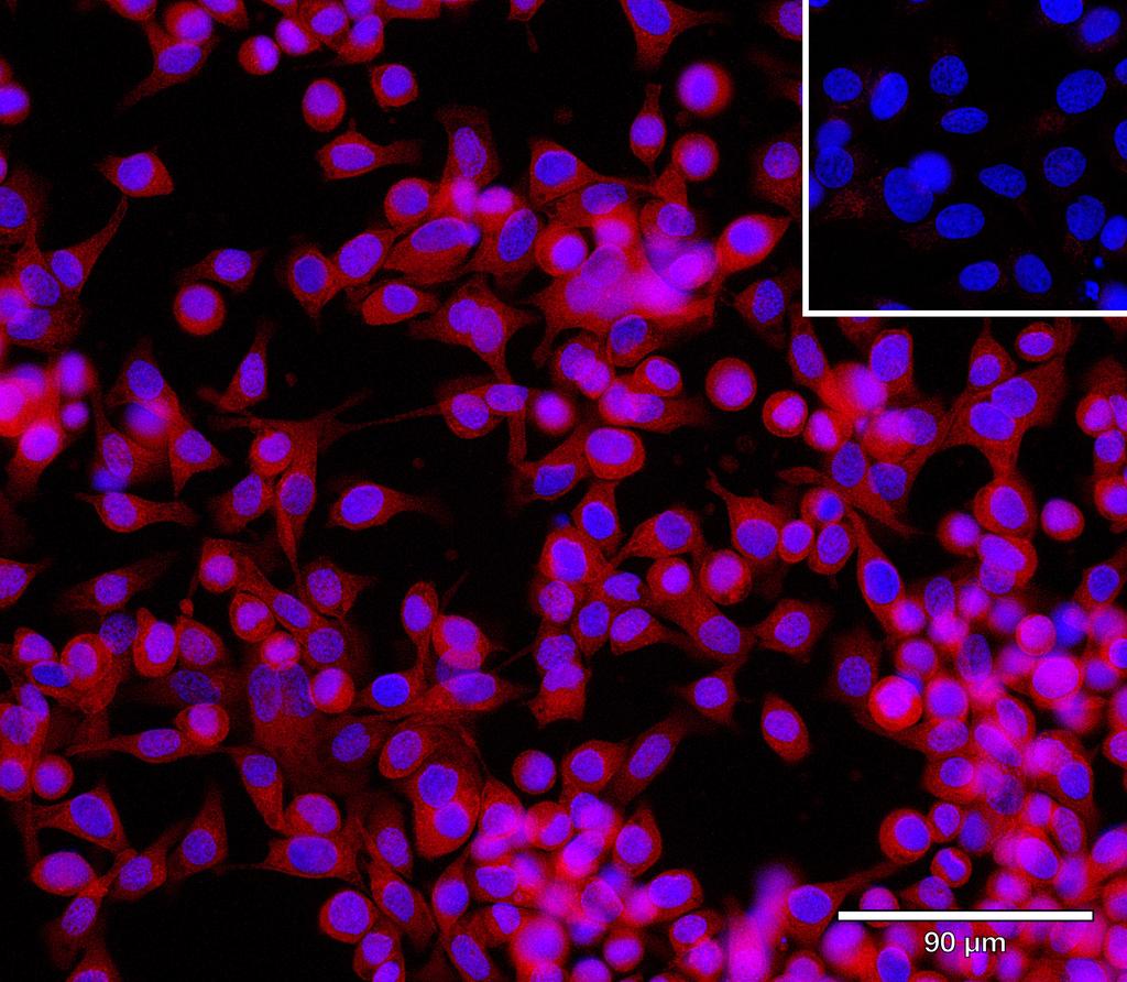 Ankyron CIB2_HUMAN Clone CV40419