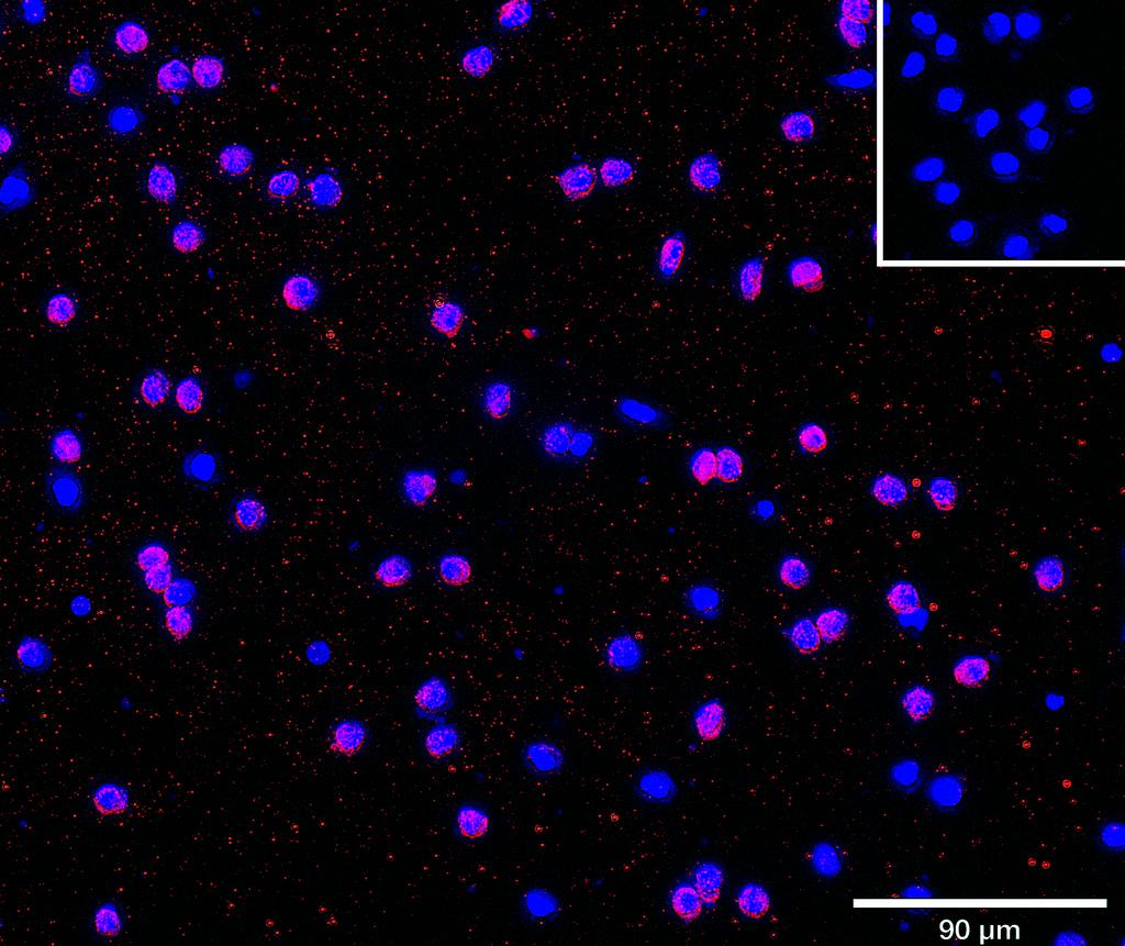 Ankyron CLC10_HUMAN Clone AY40383