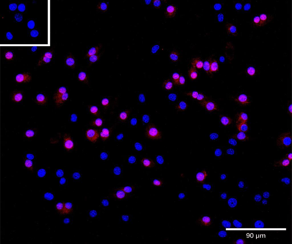Ankyron CLC1A_MOUSE Clone AS40172