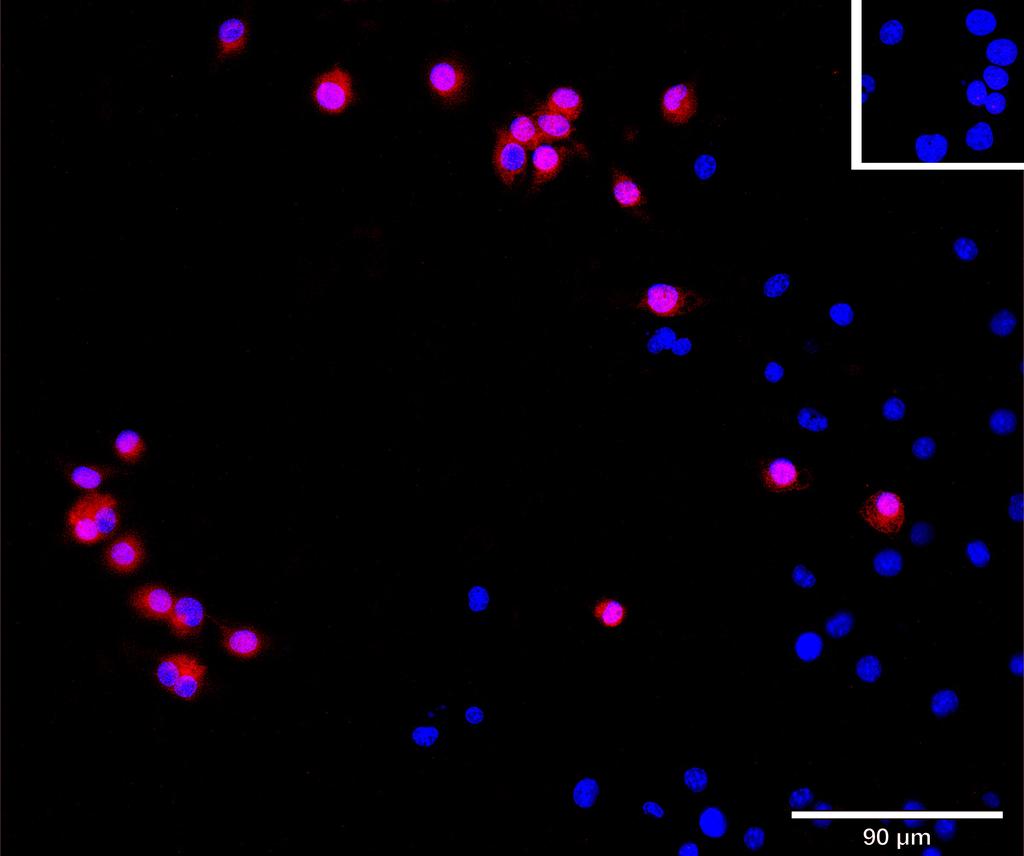 Ankyron CLC1A_MOUSE Clone AS40174