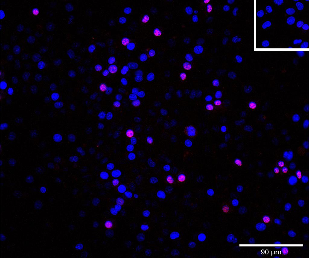 Ankyron CLC1A_MOUSE Clone AS40170