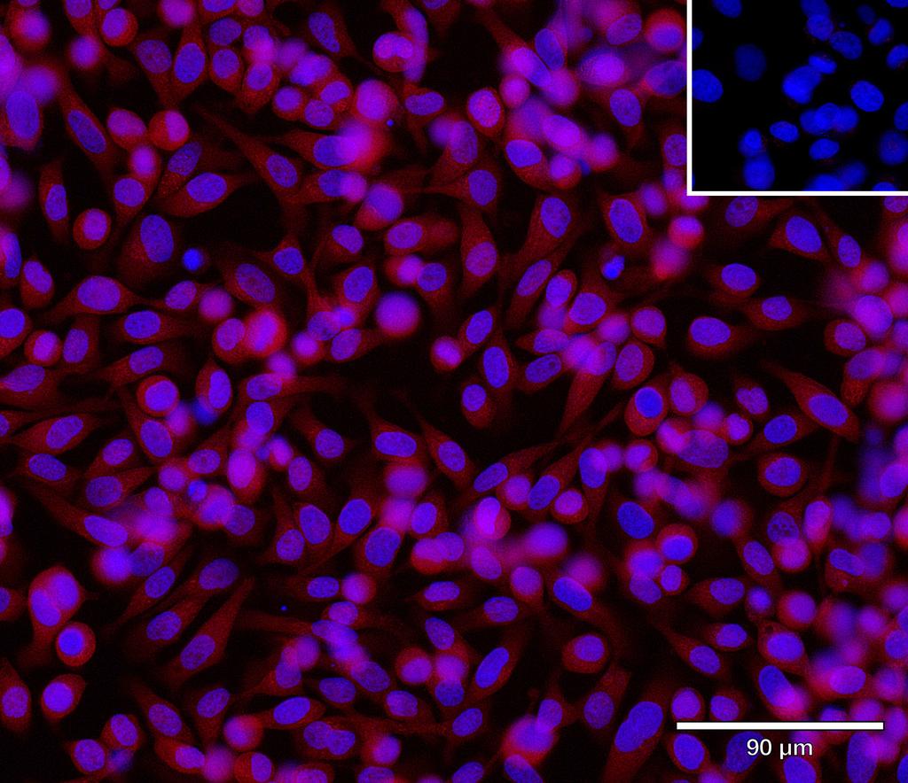 Ankyron CLC4K_HUMAN Clone DQ41103