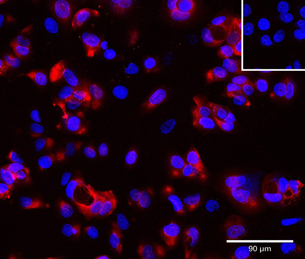 Ankyron CLC4M_HUMAN Clone AS41083