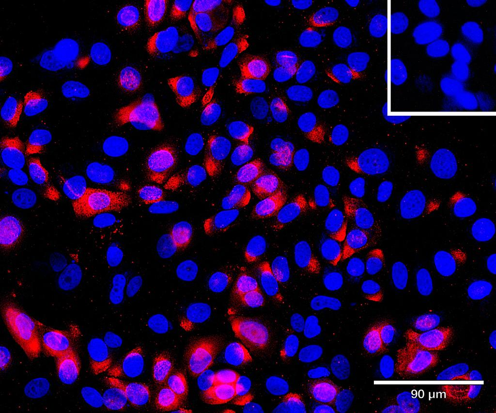 Ankyron CLC4M_HUMAN Clone AS41084