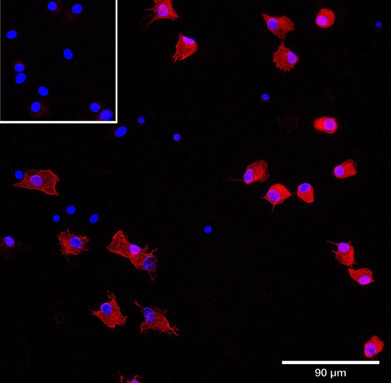 Ankyron CLC6A_HUMAN Clone AS40620