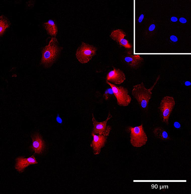 Ankyron CLC6A_HUMAN Clone AS40624