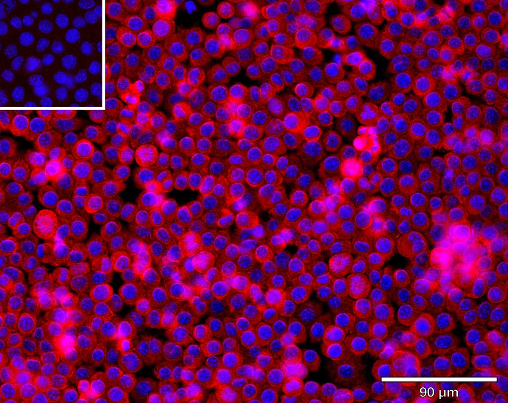 Ankyron CLC9A_MOUSE Clone AS40759