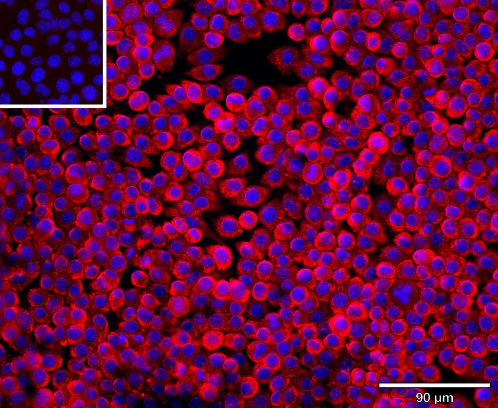 Ankyron CLC9A_MOUSE Clone AS40758