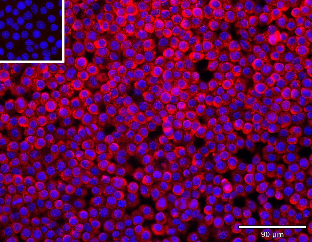 Ankyron CLC9A_MOUSE Clone AS40757