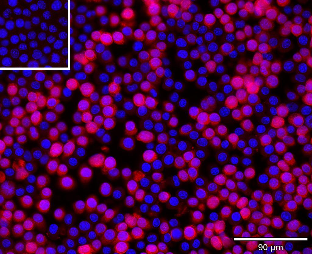Ankyron CLC9A_MOUSE Clone AS40755