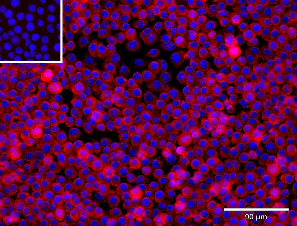 Ankyron CLC9A_MOUSE Clone AS40756