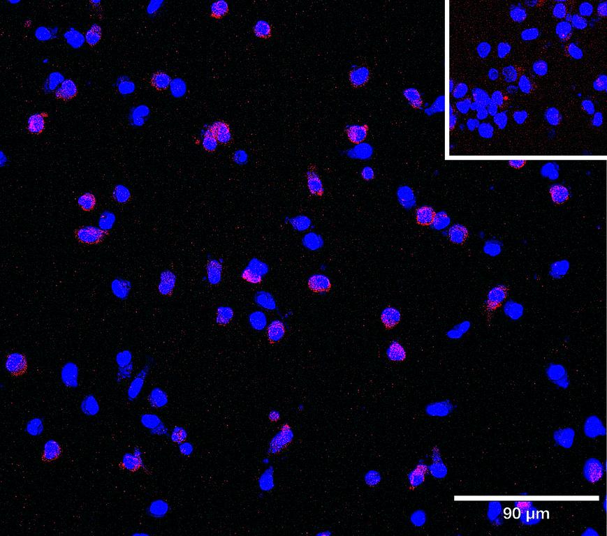 Ankyron CLM9_HUMAN Clone BN30159