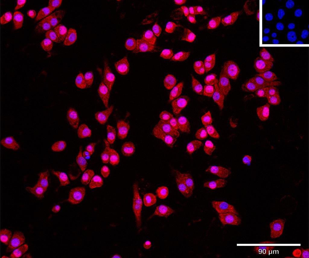 Ankyron CNDP1_MOUSE Clone AT30313