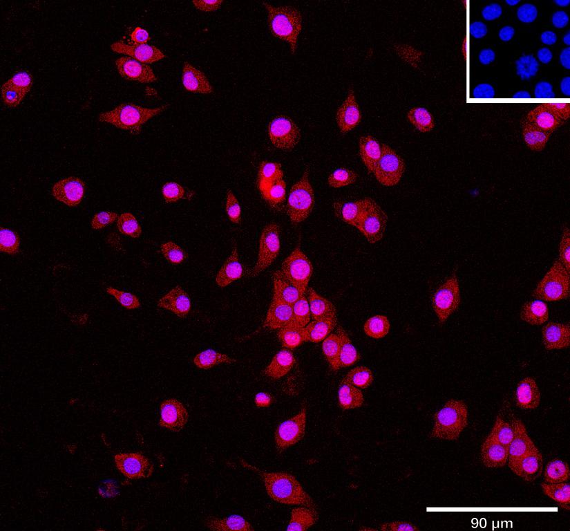 Ankyron CNDP1_MOUSE Clone AT30314