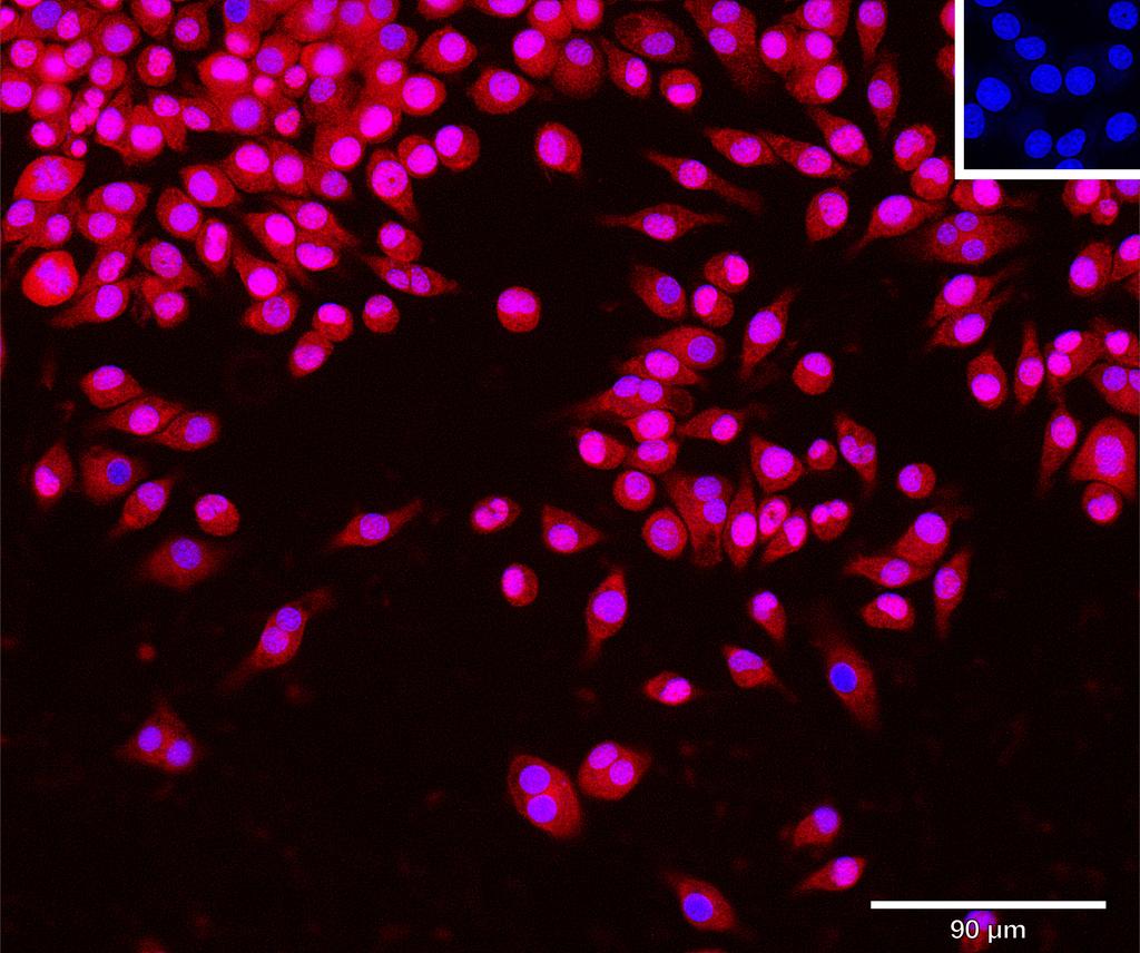 Ankyron CNDP1_MOUSE Clone AT30292