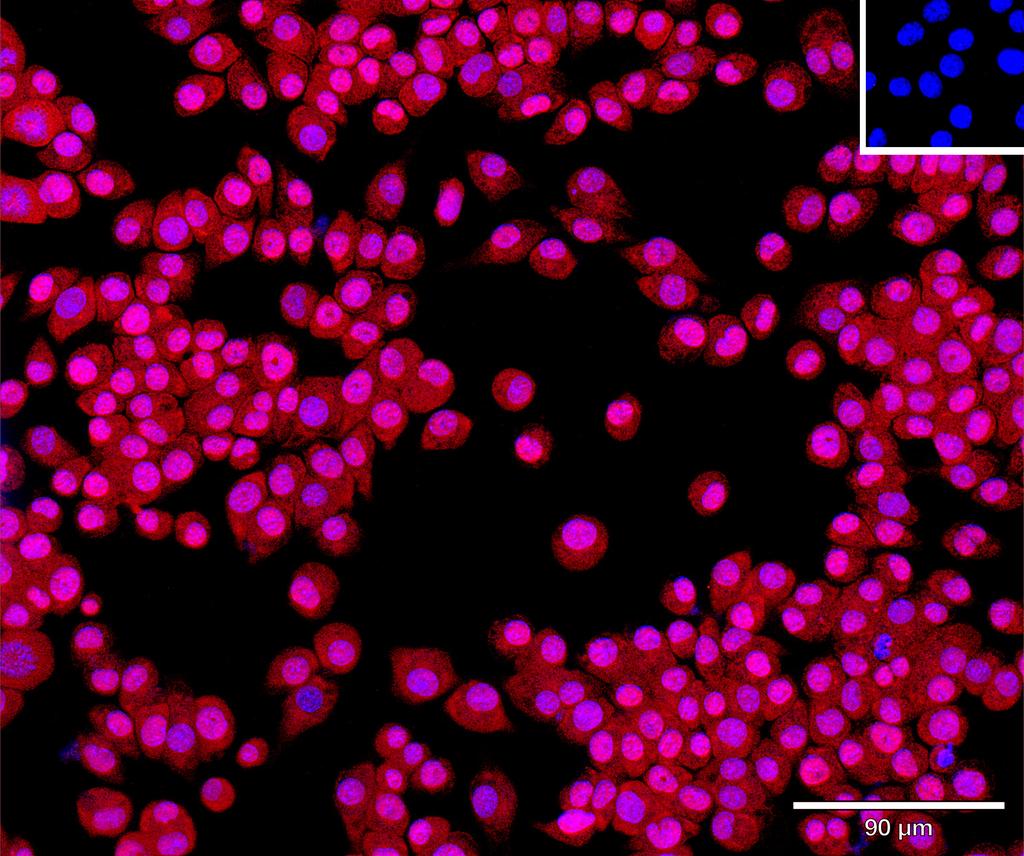 Ankyron CNDP1_MOUSE Clone AT30294