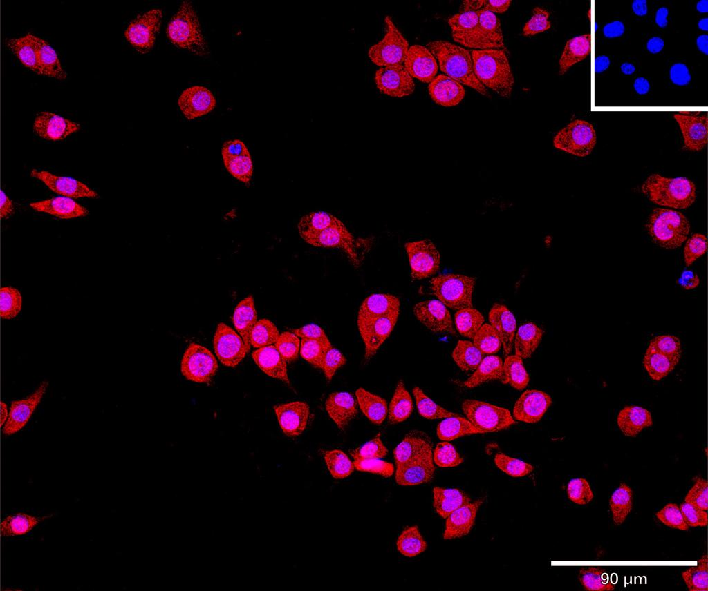 Ankyron CNDP1_MOUSE Clone AT30308