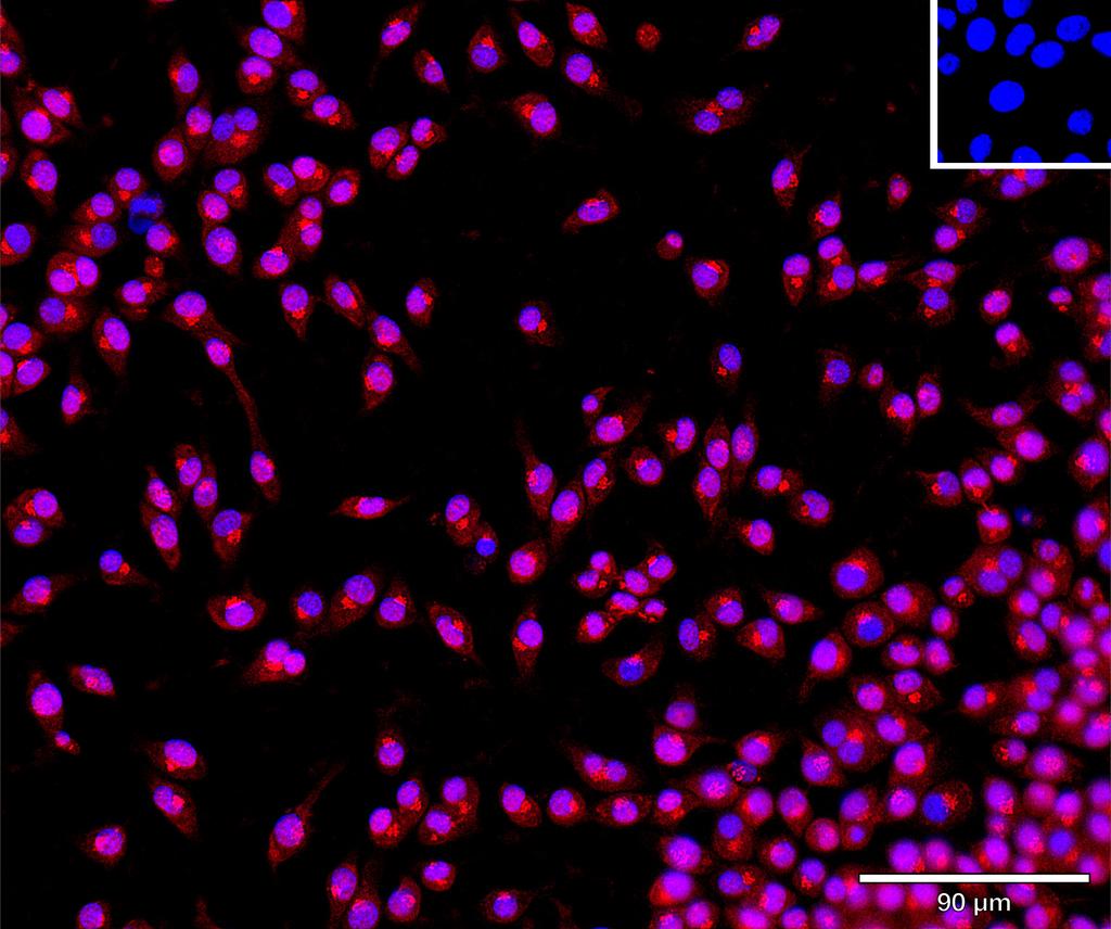 Ankyron CNDP1_MOUSE Clone AT30309