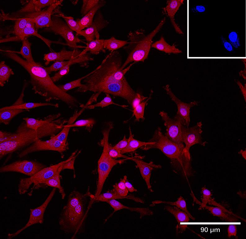 Ankyron CNTN1_HUMAN Clone BA40260