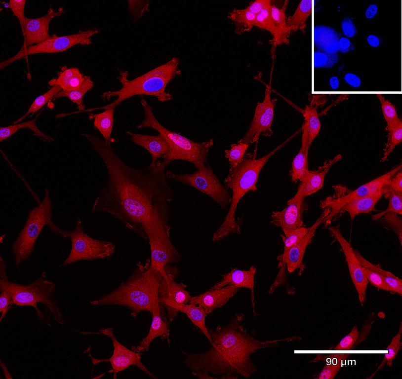 Ankyron CNTN1_HUMAN Clone BA40262