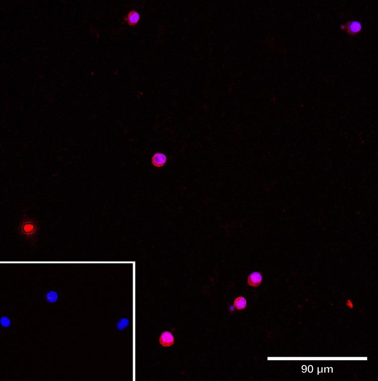 Ankyron CO4A_HUMAN Clone CO40373