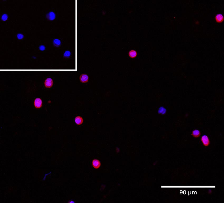 Ankyron CO7_HUMAN Clone CO40446