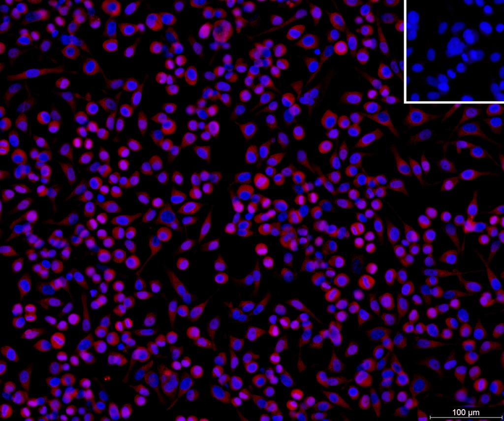 Ankyron CPNE1_HUMAN Clone CW40868