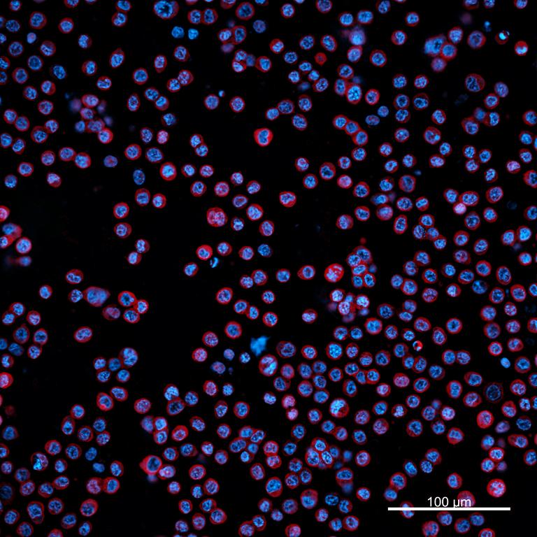Ankyron CSAG1_HUMAN Clone DB40205