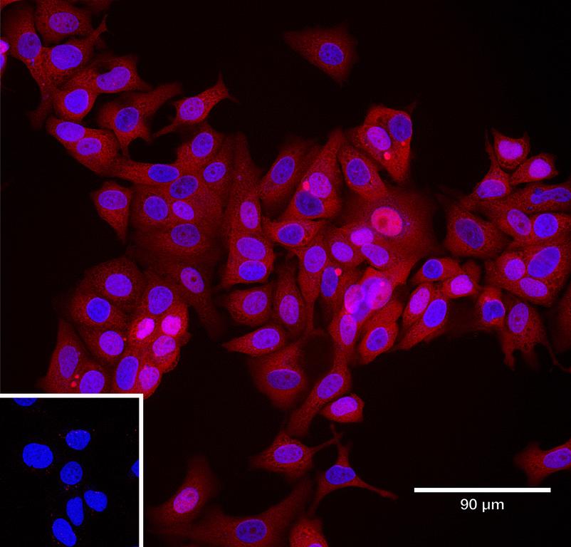 Ankyron CSF1_HUMAN Clone CI30511