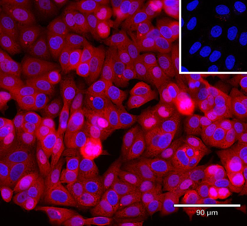 Ankyron CSF1_HUMAN Clone CI30515
