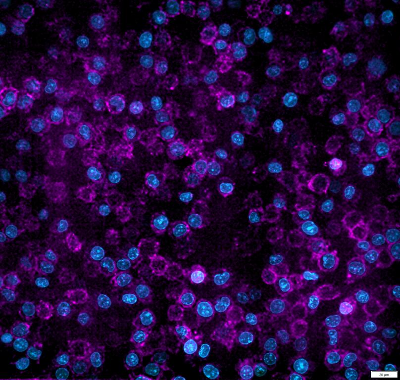 Ankyron CSF1R_MOUSE Clone CZ40632