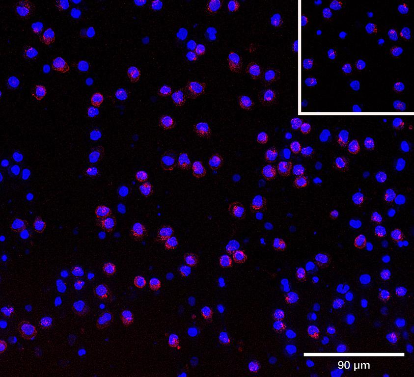 Ankyron CTLA4_HUMAN Clone AB40403