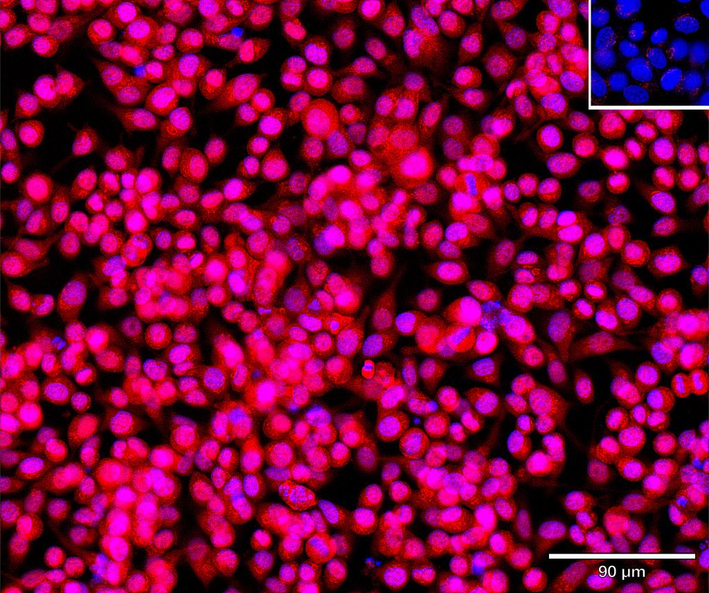 Ankyron CTNB1_HUMAN Clone EM30717