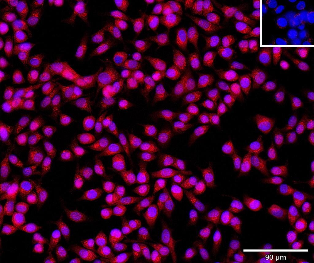 Ankyron CTNB1_HUMAN Clone EM30713