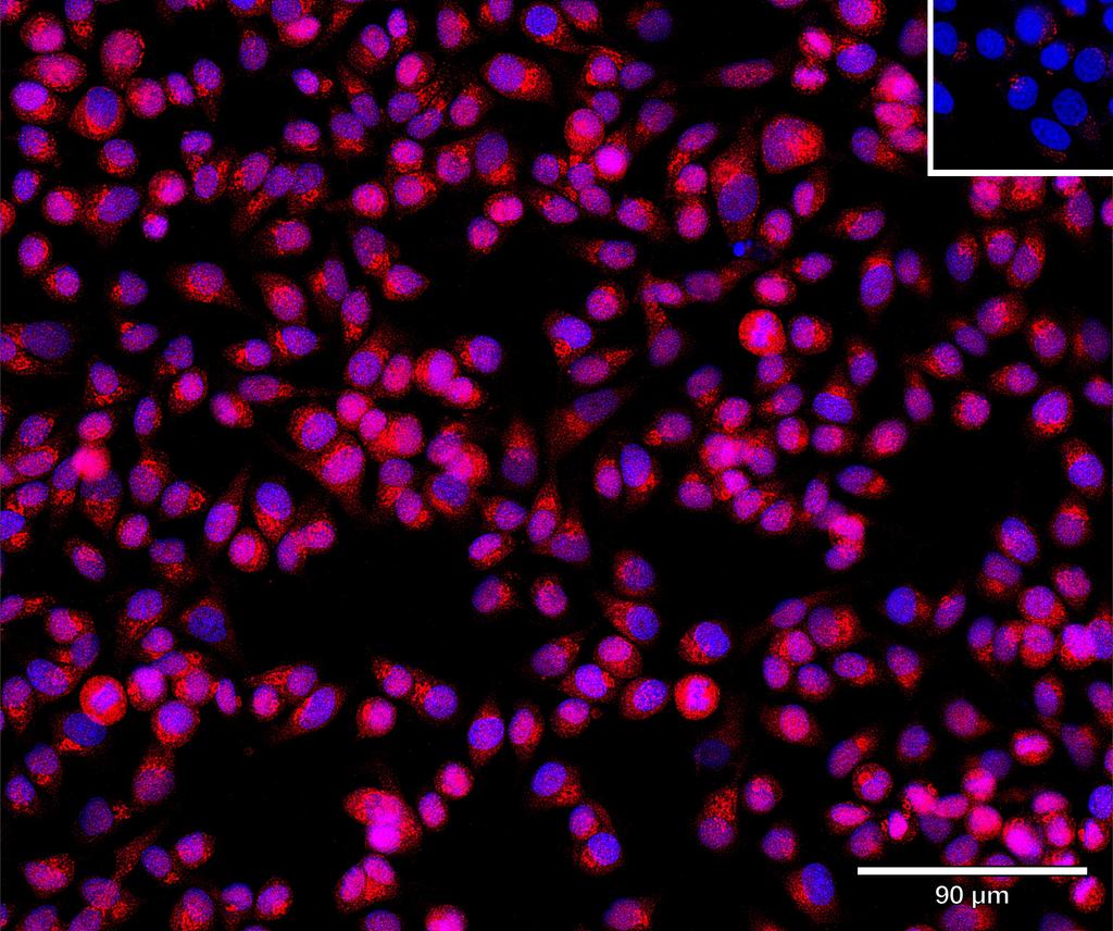 Ankyron CTNB1_HUMAN Clone EM30715