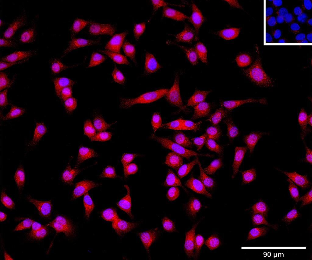 Ankyron CTNB1_HUMAN Clone EM30718