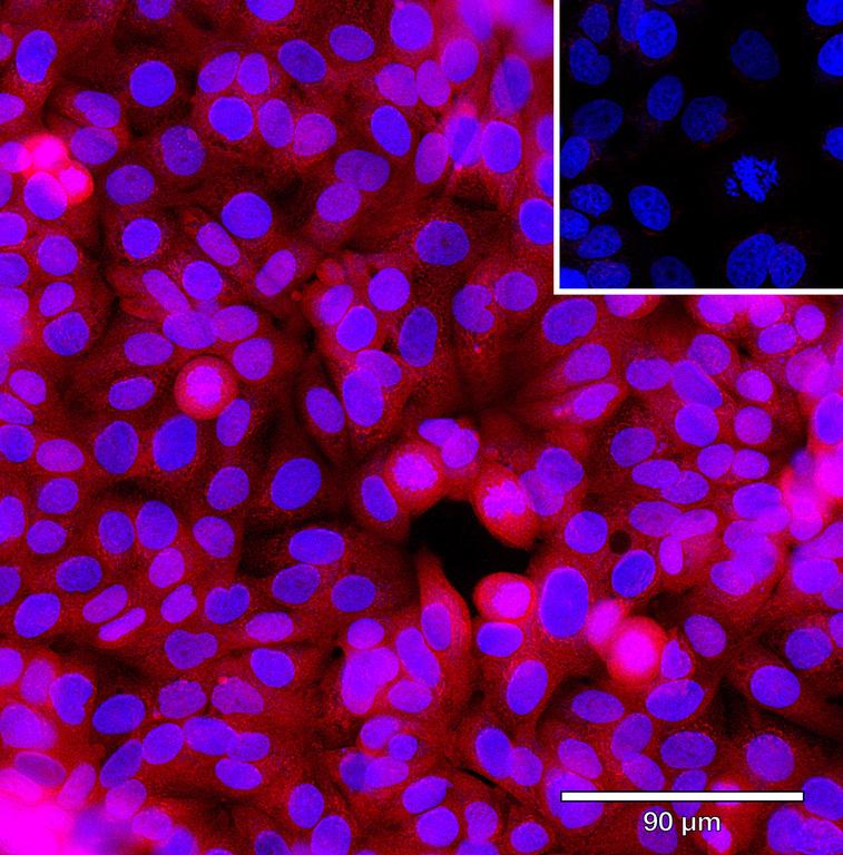 Ankyron CYTA_HUMAN Clone BP40303