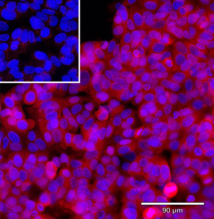 Ankyron CYTA_HUMAN Clone CV40194