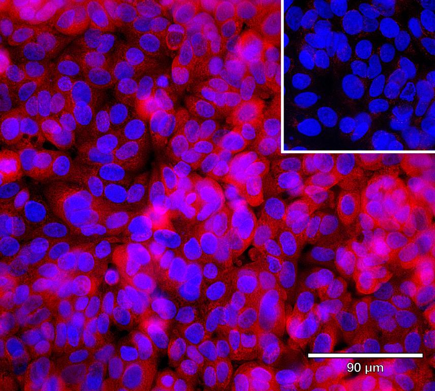 Ankyron CYTA_HUMAN Clone CV40202