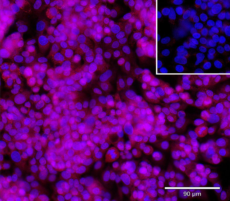 Ankyron DCBD2_HUMAN Clone AR40620