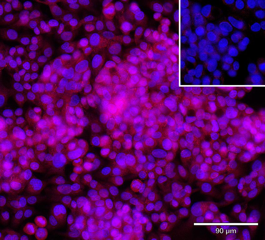 Ankyron DCBD2_HUMAN Clone AR40621