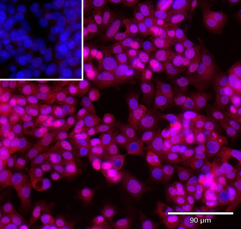 Ankyron DCBD2_HUMAN Clone AR40622