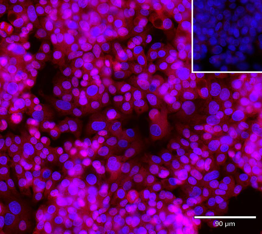 Ankyron DCBD2_HUMAN Clone AR40623