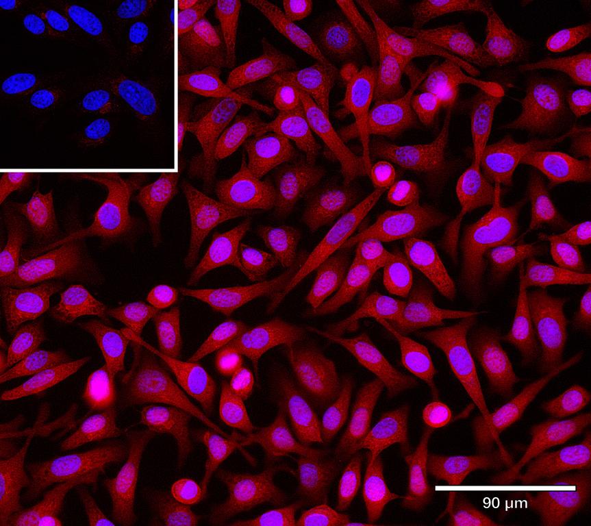 Ankyron DCBD2_HUMAN Clone AR40624