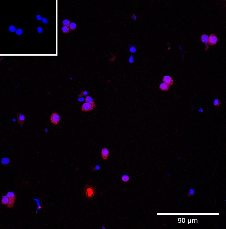Ankyron DCNL2_HUMAN Clone CW40842